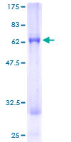 12.5% SDS-PAGE Stained with Coomassie Blue.